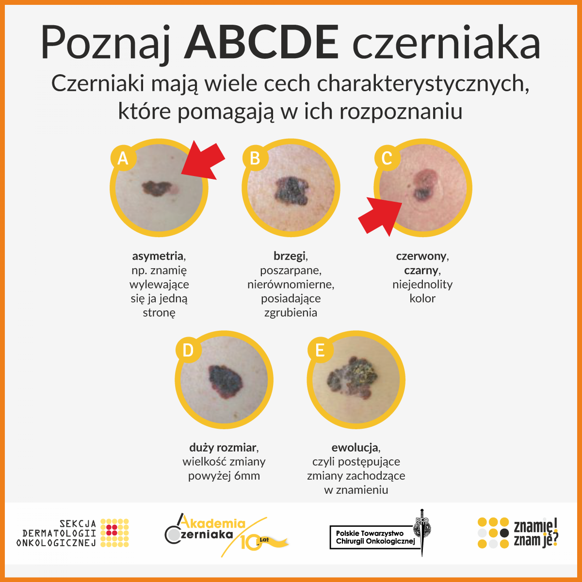 Plakat przedstawiające zmiany na pieprzykach.